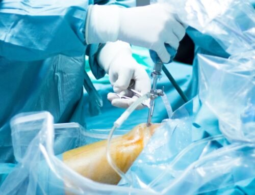 🦵 ARTHROSCOPY OPERATIONS  Precision, Minimally Invasive Joint Repair